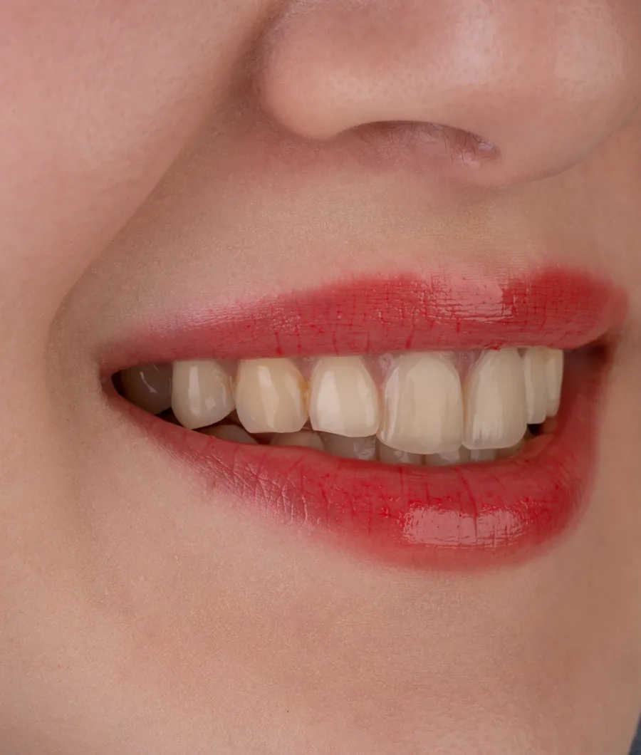 Sorriso antes do tratamento