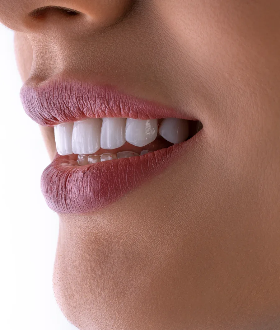 Sorriso depois do tratamento